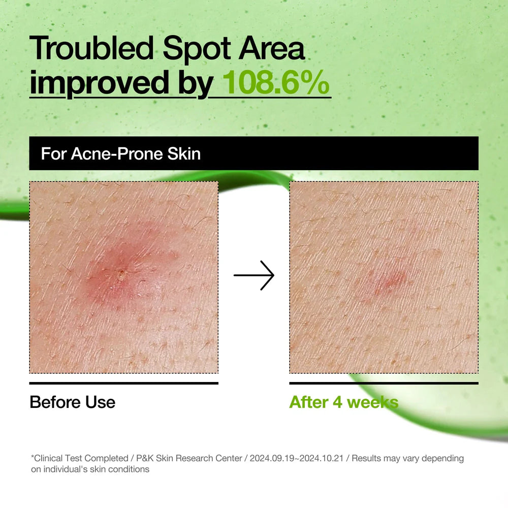 Anua PDRN Hyaluronic Acid Capsule 100 Serum 30ml