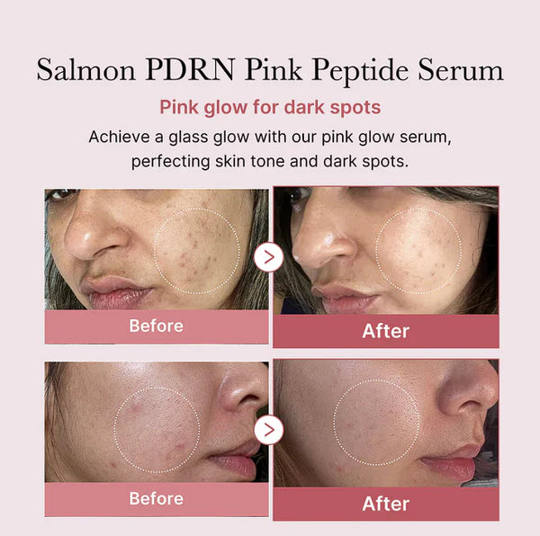 Medicube PDRN Pink Peptide Serum 30ml