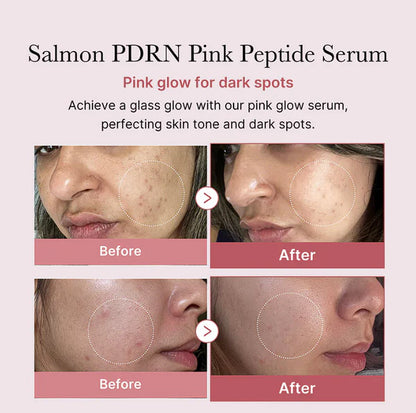 Medicube PDRN Pink Peptide Serum 30ml